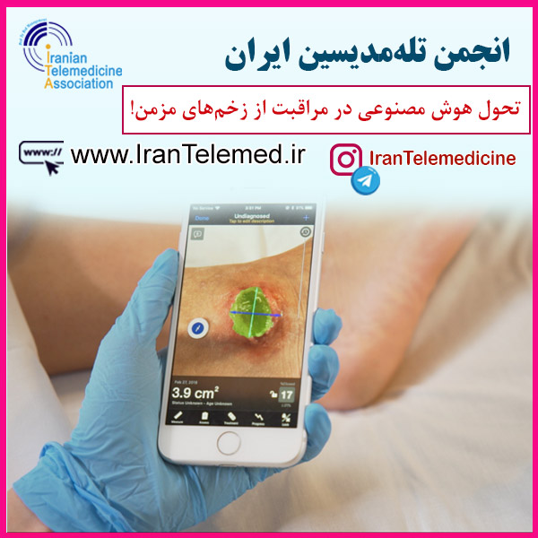 تحول هوش مصنوعی در مراقبت از زخم‌های مزمن!