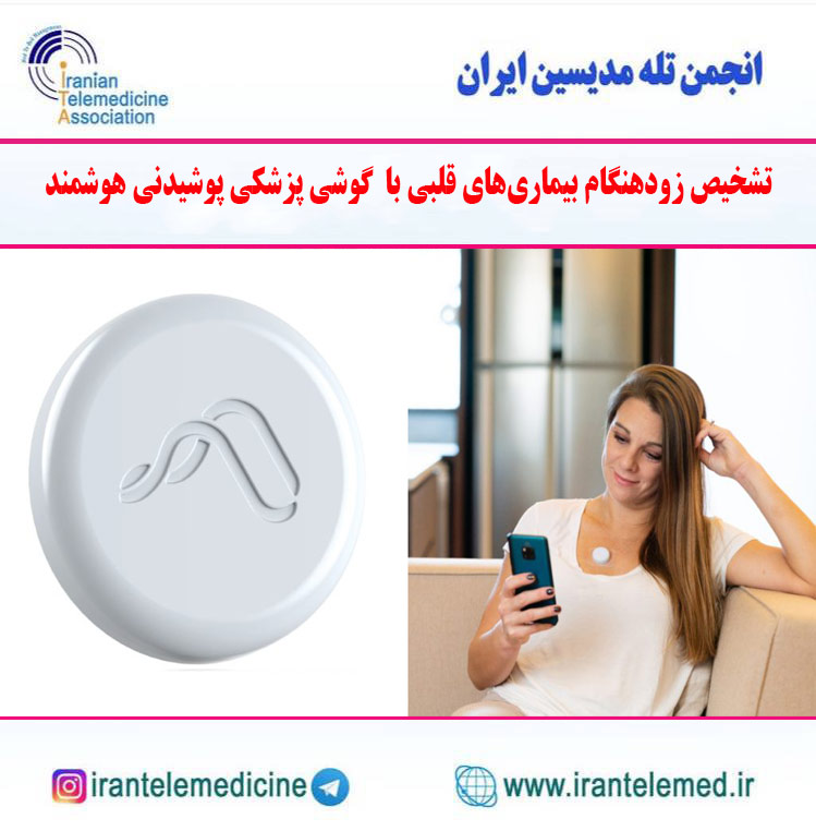 تشخیص زودهنگام بیماری‌های قلبی با  گوشی پزشكی پوشیدنی هوشمند